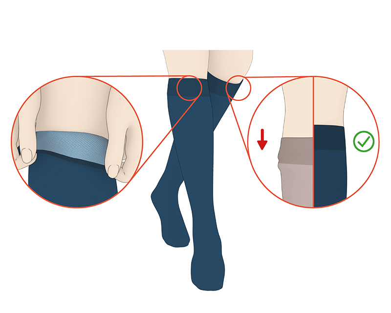 Illustration showing JOBST SoftFit stockings with a secure top band preventing the stockings from sliding down. Illustration showing JOBST SoftFit stockings with a secure top band preventing the stockings from sliding down.